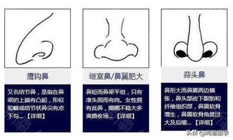 鼻面相|鼻相